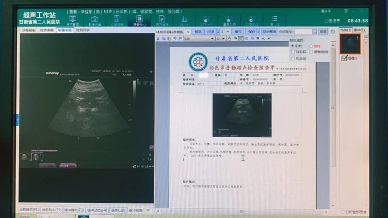 广州体检预约当天能拿到报告吗？揭秘体检报告发放流程